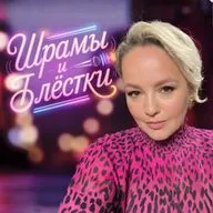 Шрамы и блёстки. Татьяна Лазарева