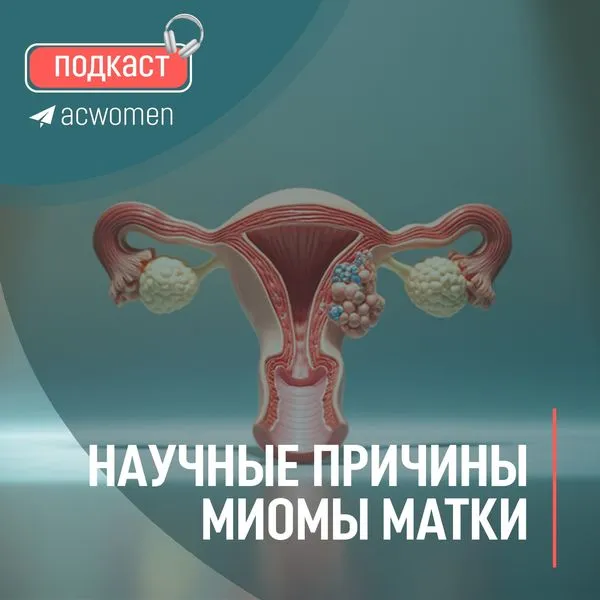 🎧Подкаст «Научные причины миомы матки»