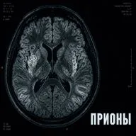 Прионы. Овцы, поедание мозгов и украденные дети