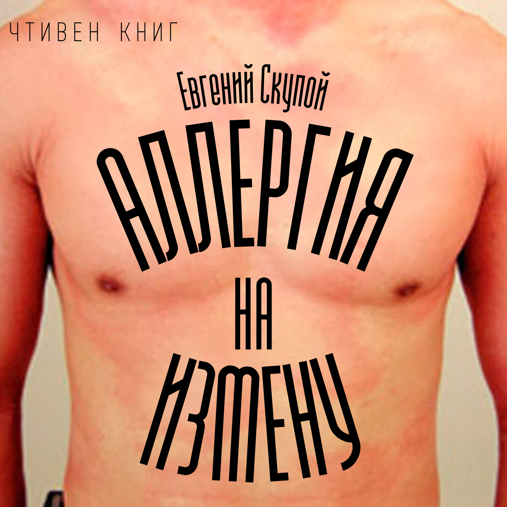Евгений Скупой - Аллергия на измену episode artwork