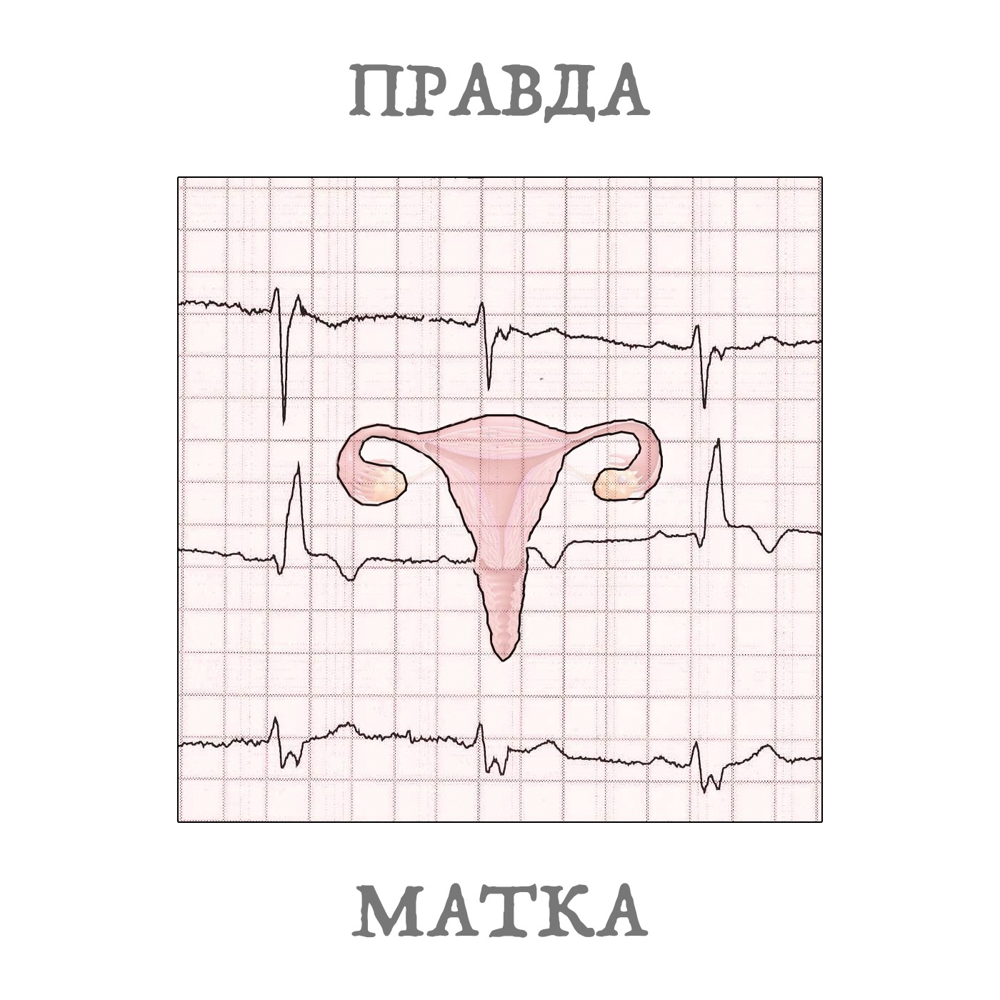 Правда-Матка. 02.04. Как родить без матки. Усыновление и суррогатное материнство. podcast
