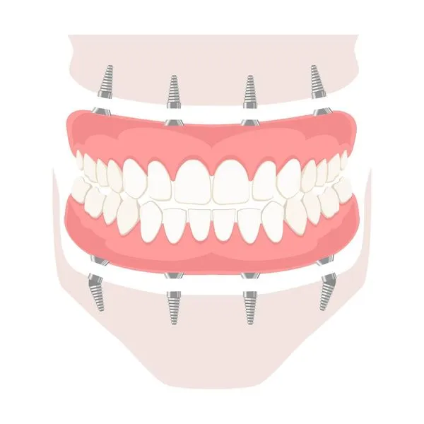 Smile Anatomy