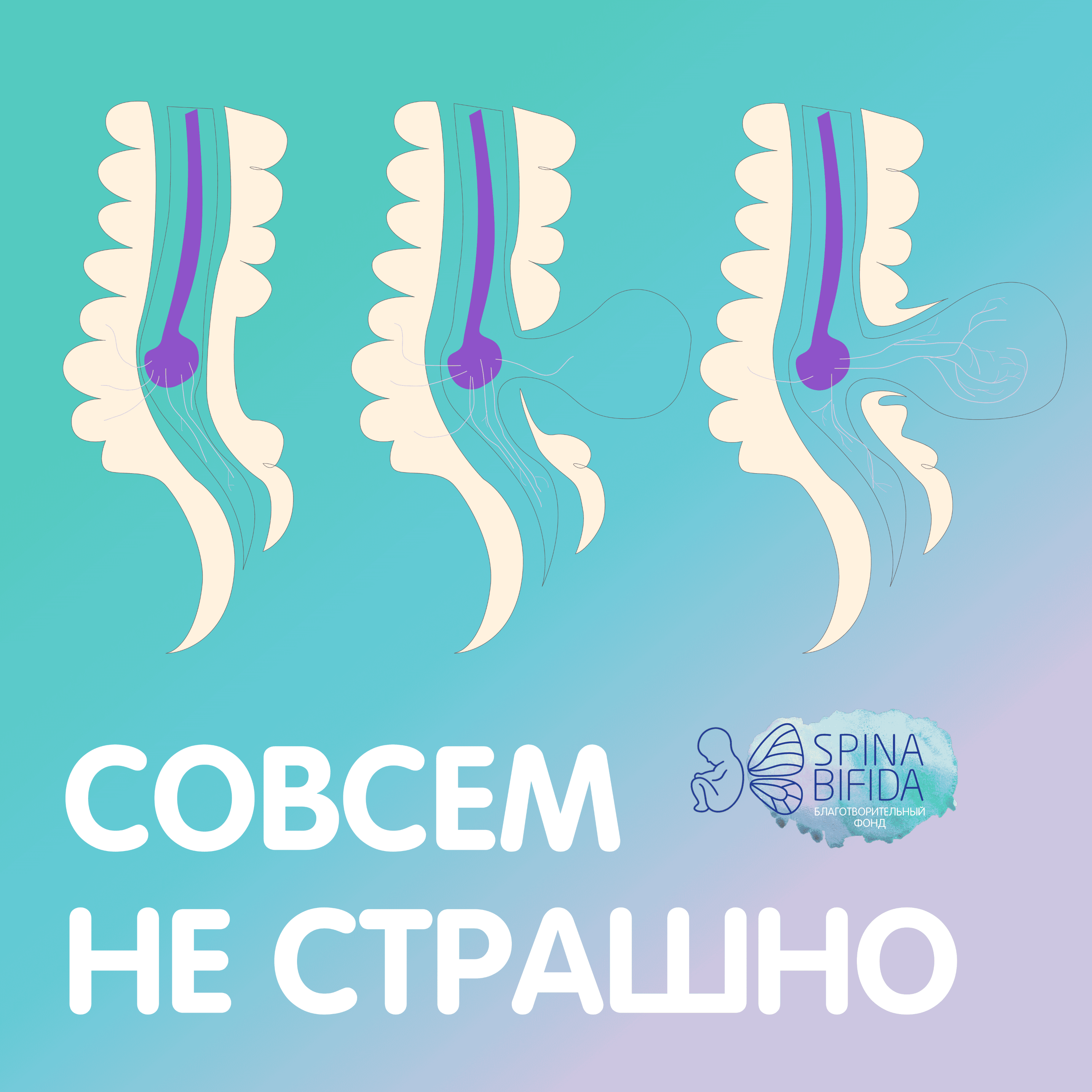 Формы spina bifida episode artwork