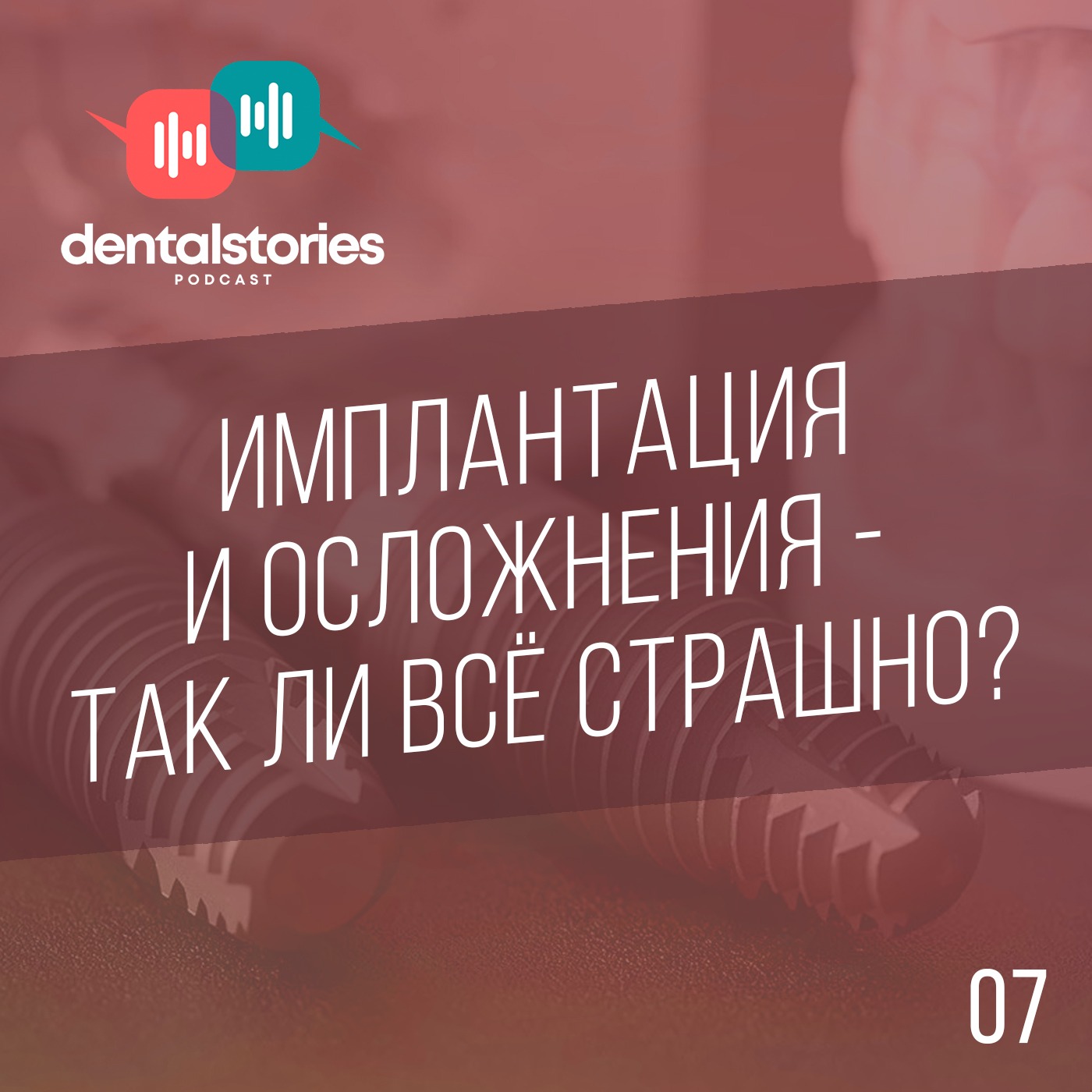 Имплантация и осложнения - так ли всё страшно?! Баграт Смбатян / Dental Stories №7
