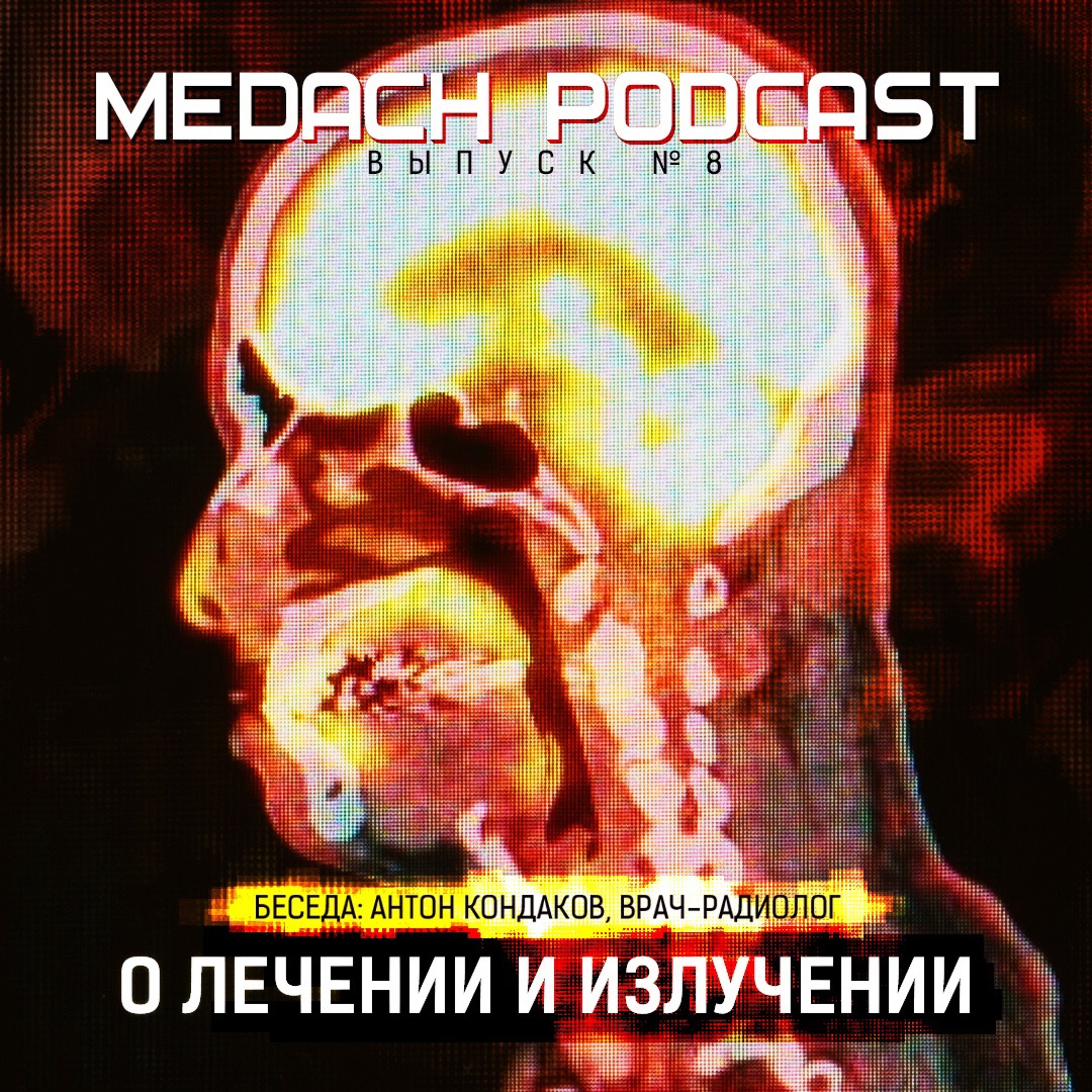 О лечении и излучении